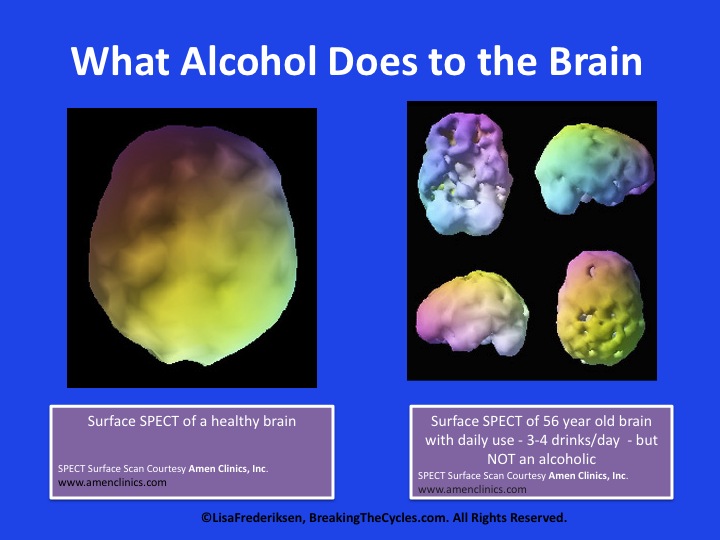 blacking out alcohol brain damage 2 beer
